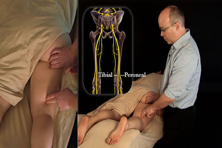 Nerve Mobilization The Lower Body Video on DVD & Streaming Version - Real Bodywork